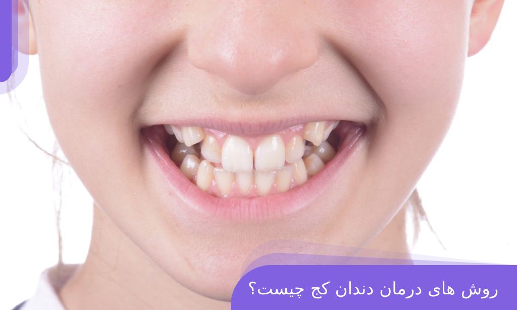 درمان دندان کج