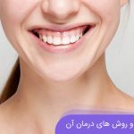 لبخنده لثه ای چیست