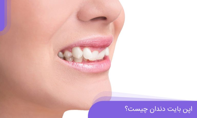 اپن بایت چیست