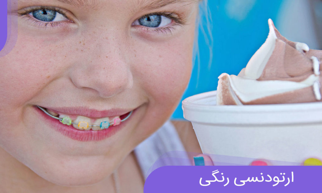ست کردن رنگ لاک با رنگ ارتودنسی کودکان