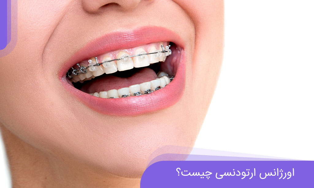 اورژانس ارتودنسی
