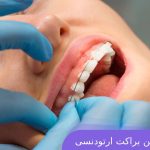 نکات برداشتن ارتودنسی از روی دندان