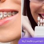 ارتودنسی و لمینت، دو روش بهبود و اصلاح دندان‌ها هستند.