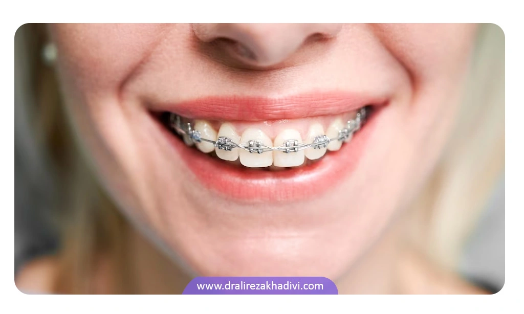 ارتودنسی یک روش اصلاح ساختار و چینش دندان‌هاست.