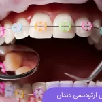 نیاز به درمان ارتودنسی برای سلامت و زیبایی دندان