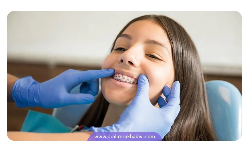 سن مناسب برای انجام ارتودنسی دندان