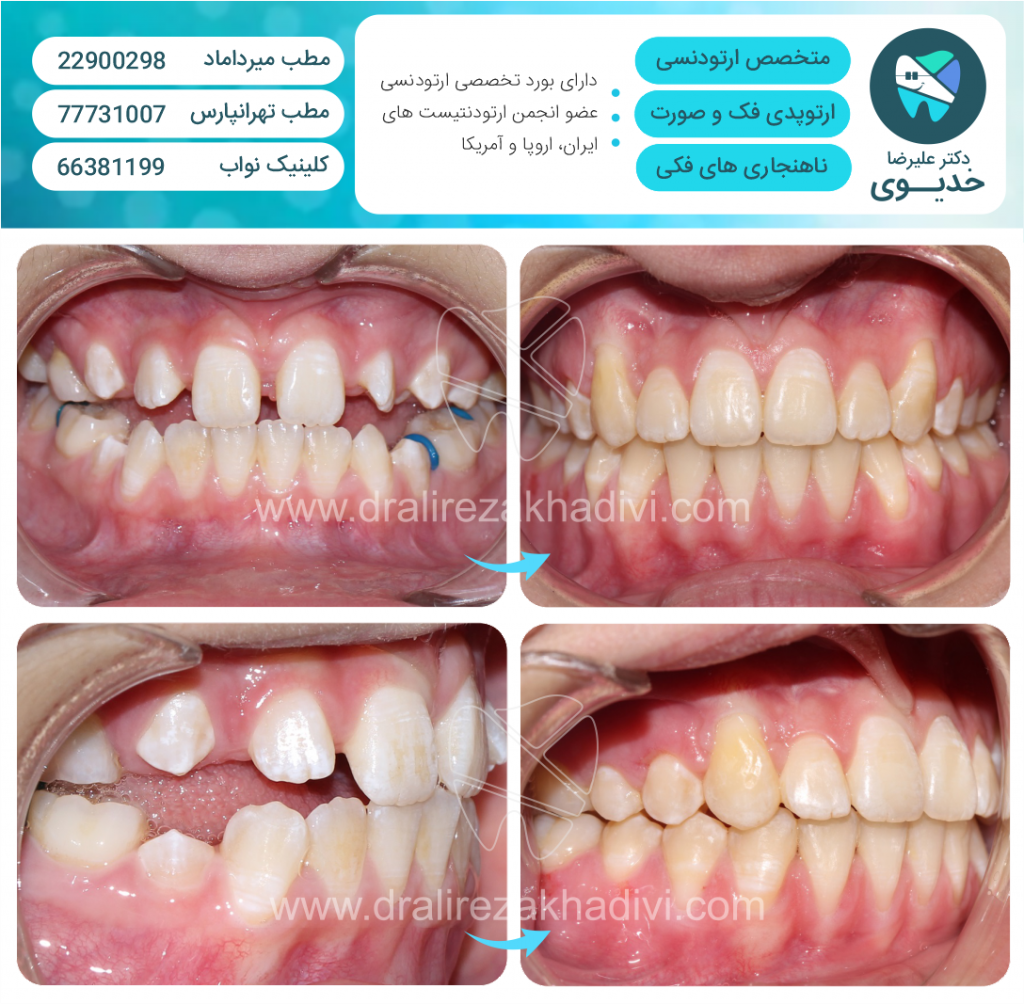 https://www.dralirezakhadivi.com/wp-content/uploads/2019/11/4-1024x1004.png
