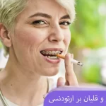 ایا سیگار برای ارتودنسی مضر است