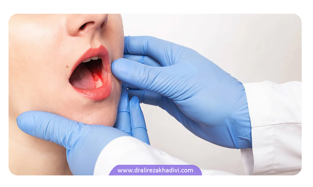 درمان هالیتوز نزد دندانپزشک
