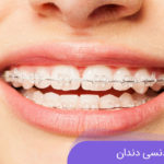 فواید و مزایای ارتودنسی دندان