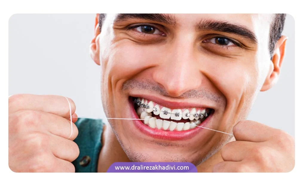 اهمیت استفاده از نخ دندان ارتودنسی