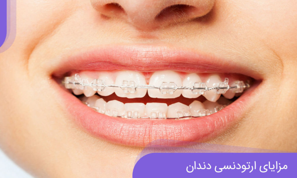 فواید و مزایای ارتودنسی دندان