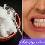 نکات سفید کردن دندان با روغن نارگیل