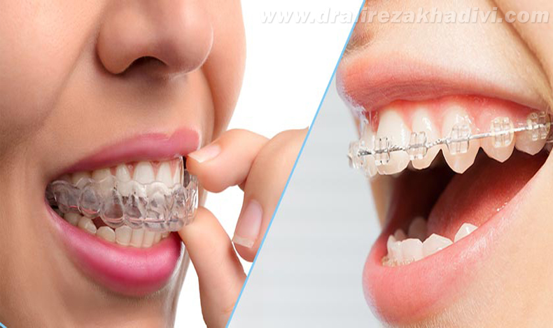ارتودنسی ثابت و متحرک ارتودنسی ثابت و متحرک