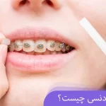 موم ارتودنسی