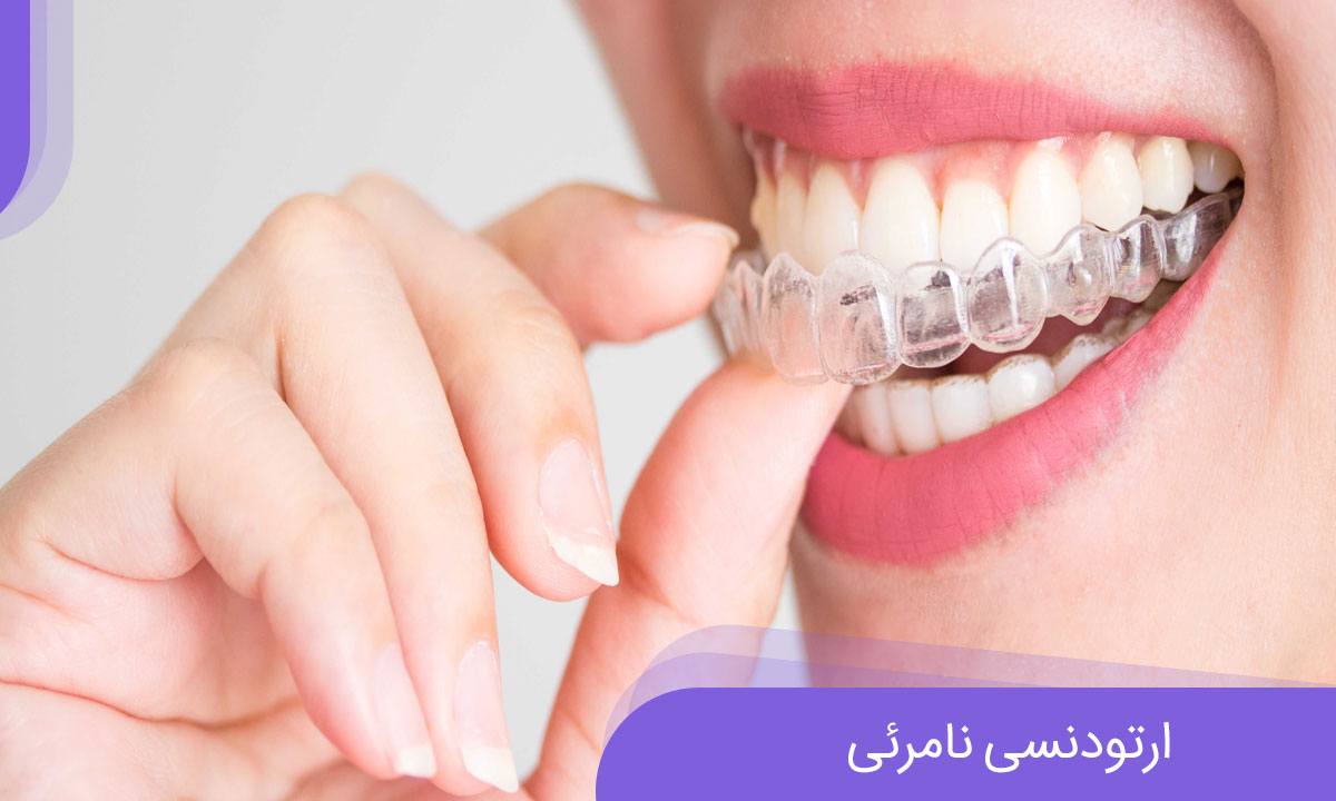 همه چیز درباره ارتودنسی نامرئی همه چیز درباره ارتودنسی نامرئی