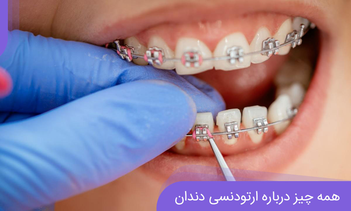 همه چیز درباره ارتودنسی دندان همه چیز درباره ارتودنسی دندان