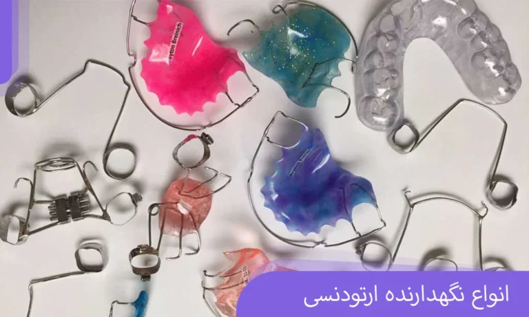انواع نگهدارنده ارتودنسی
