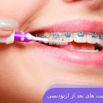 مراقبت های ارتودنسی