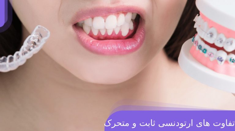 فرق ارتودنسی ثابت و متحرک