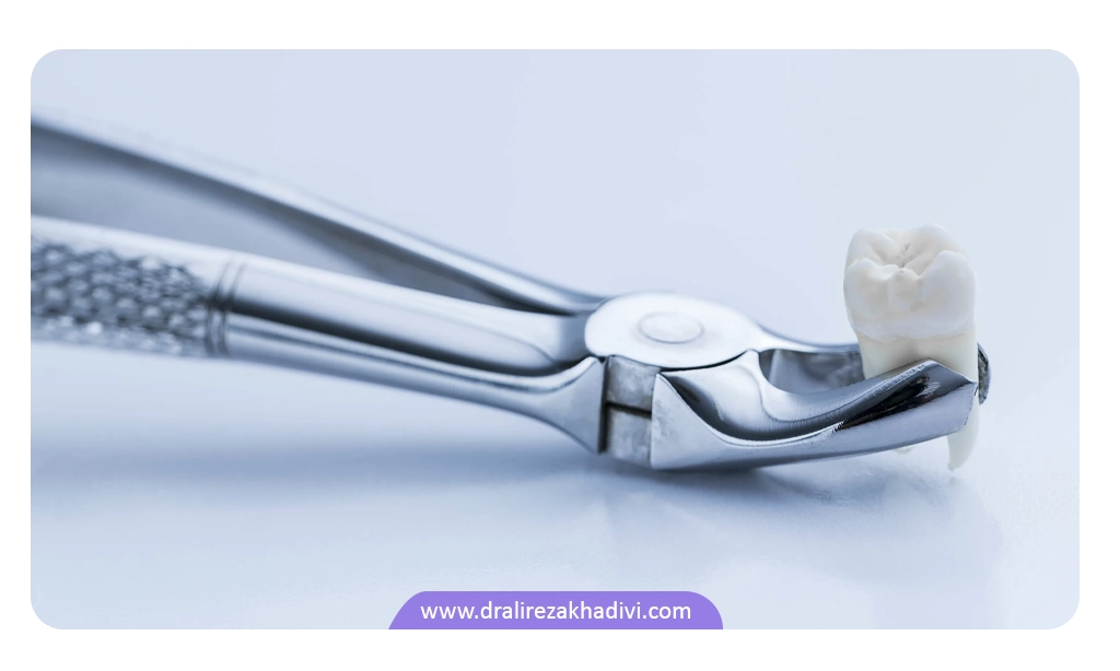 معایب کشیدن دندان در ارتودنسی