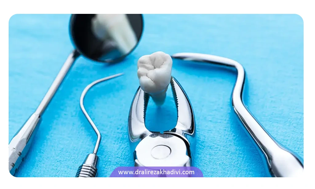 مزایای کشیدن دندان در ارتودنسی