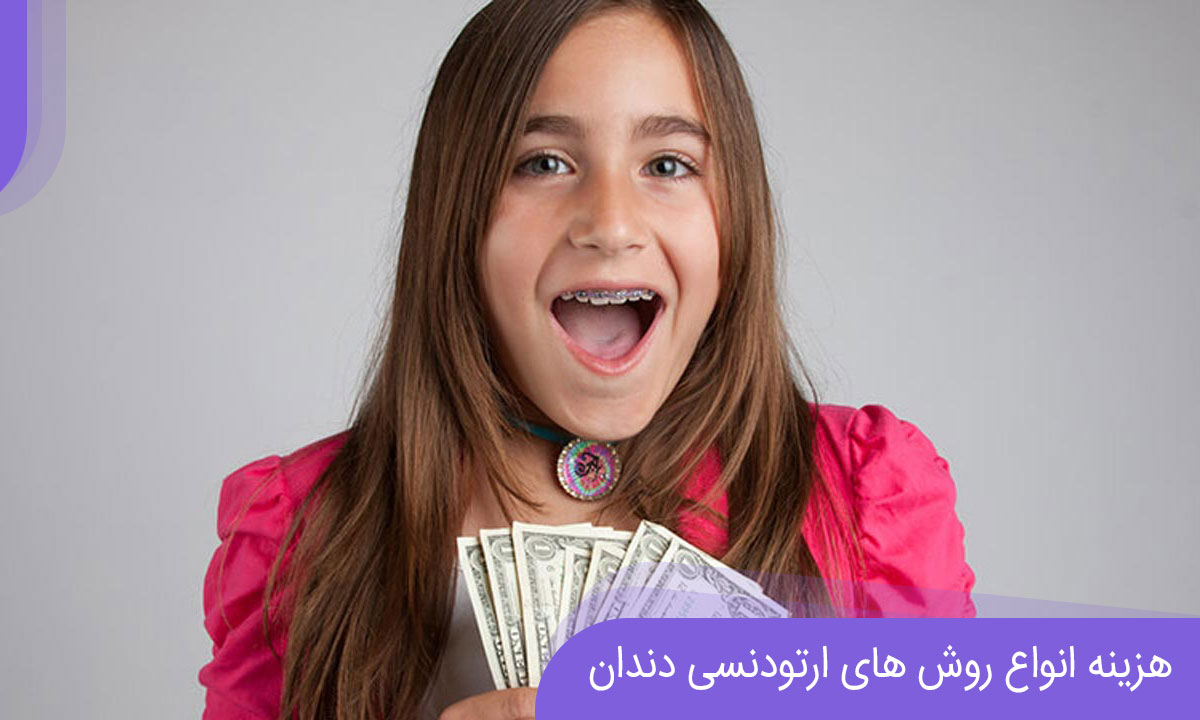 هزینه ارتودنسی دندان در سال 1401 چقدر است؟ هزینه ارتودنسی دندان در سال 1401 چقدر است؟