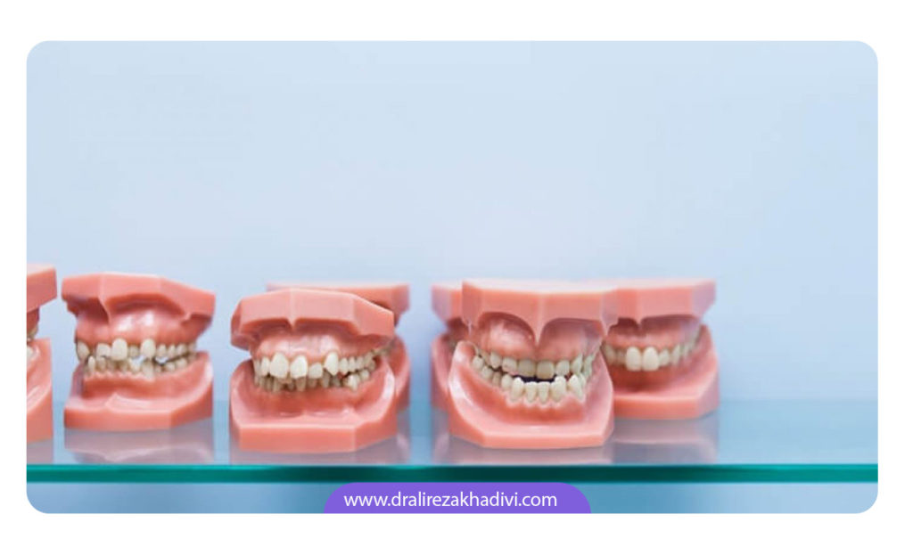 تصویر مولاژ انواع ناهنجاری های فکی و دندانی