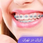 ارتودنسی اقساطی در تهران