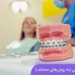 هزینه ارتودنسی (به روش های مختلف)