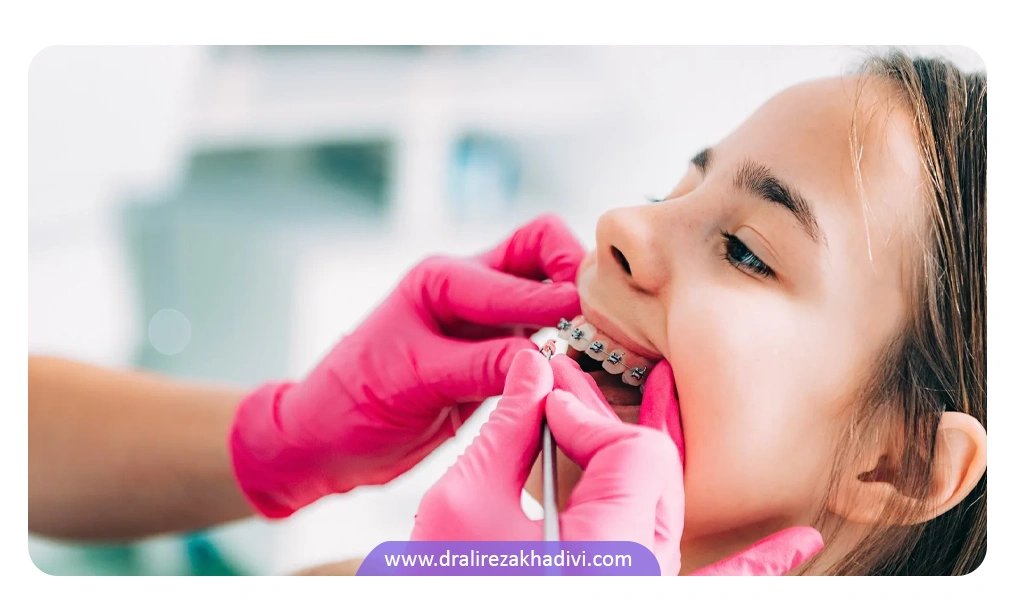قیمت سیم کشی دندان در کودکان و بزرگسالان با توجه میزان سختی کار و طول درمان ممکن است متفاوت باشد.