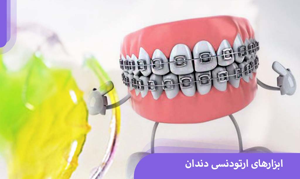 ابزارهای ارتودنسی دندان