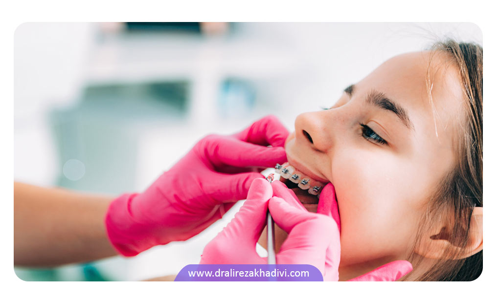 مزایای سیم کشی دندان کودکان