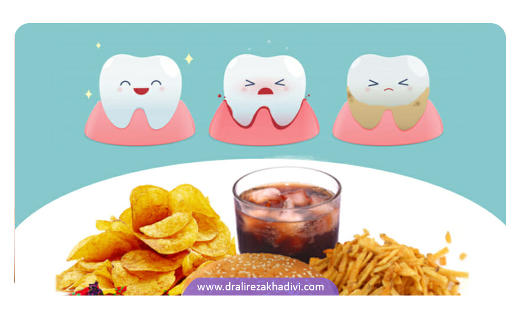 پرهیز از مواد غذایی مضر برای جلوگیری از پوسیدگی دندانها