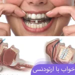 درمان آپنه خواب با ارتودنسی