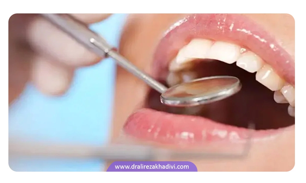 درمان دندان خرگوشی با روش هایی مثل ارتودنسی انجام می شود