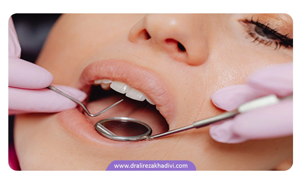 کاربردهای روکش دندان