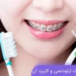 معرفی مسواک ارتودنسی و انواع آن