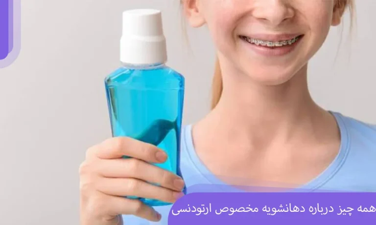 همه چیز درباره دهانشویه مخصوص ارتودنسی