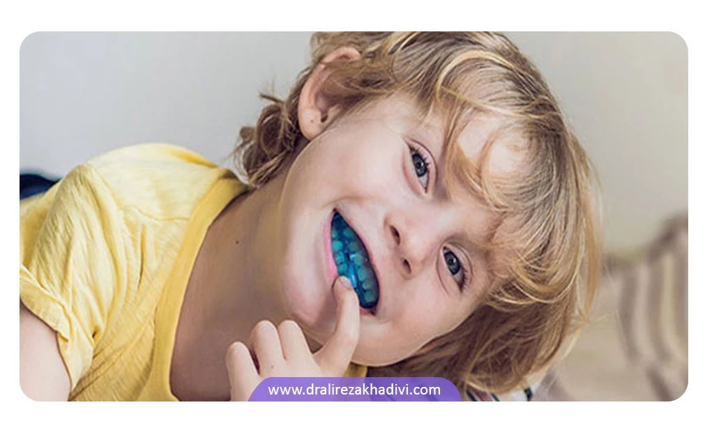درمان دندان قروچه کودکان در خواب با گارد محافظ