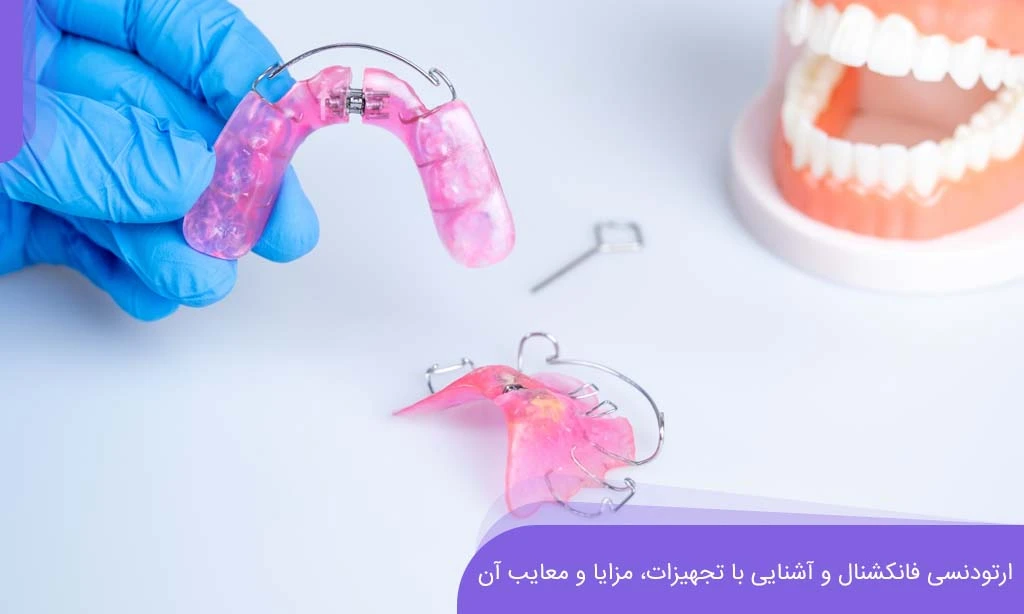ارتودنسی فانکشنال و آشنایی با تجهیزات آن