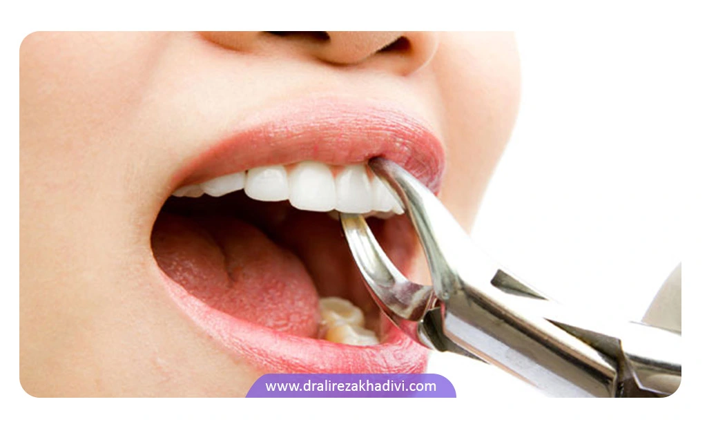 درمان اورجت با کشیدن برخی از دندان ها
