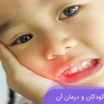 عفونت لثه کودکان و درمان آن