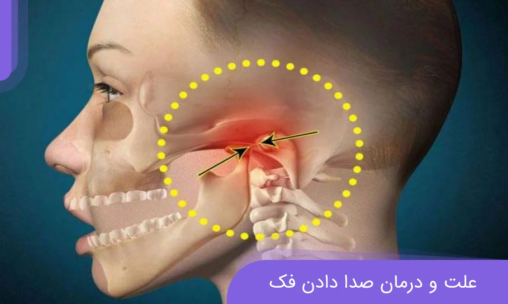 عارضه صدا دادن فک و روش های درمان