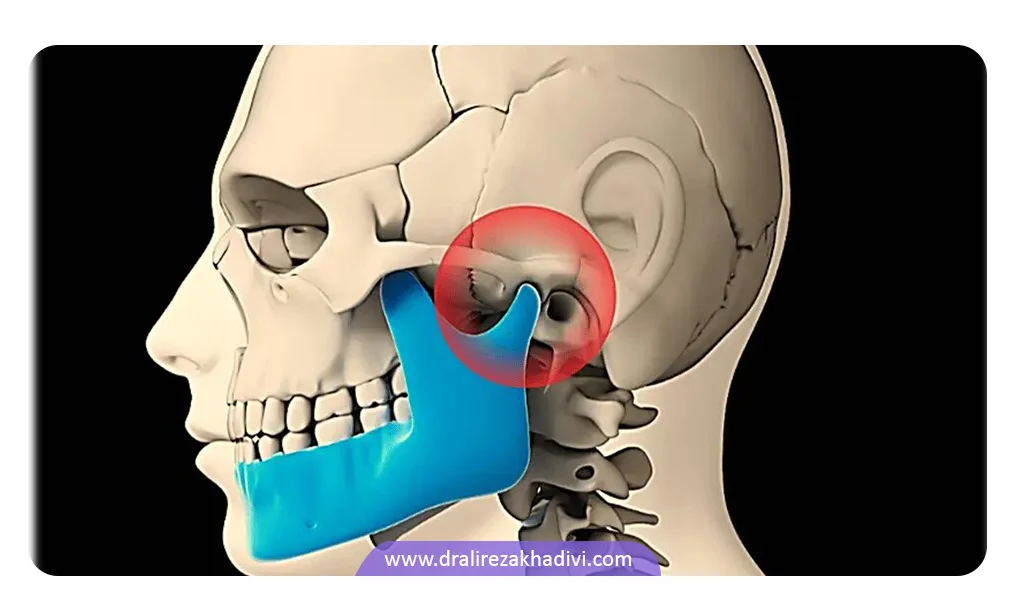 صدا دادن فک ناشی از اختلال در مفاصل فک است
