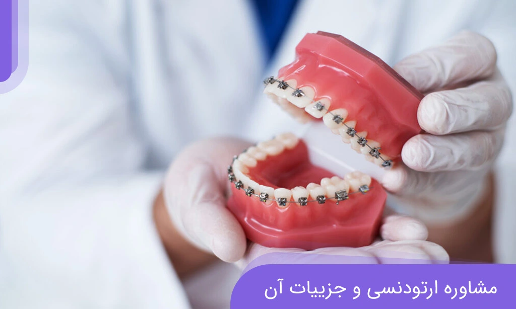 مشاهده ارتودنسی و جزییات آن