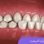 همه چیز درمورد آندربایت