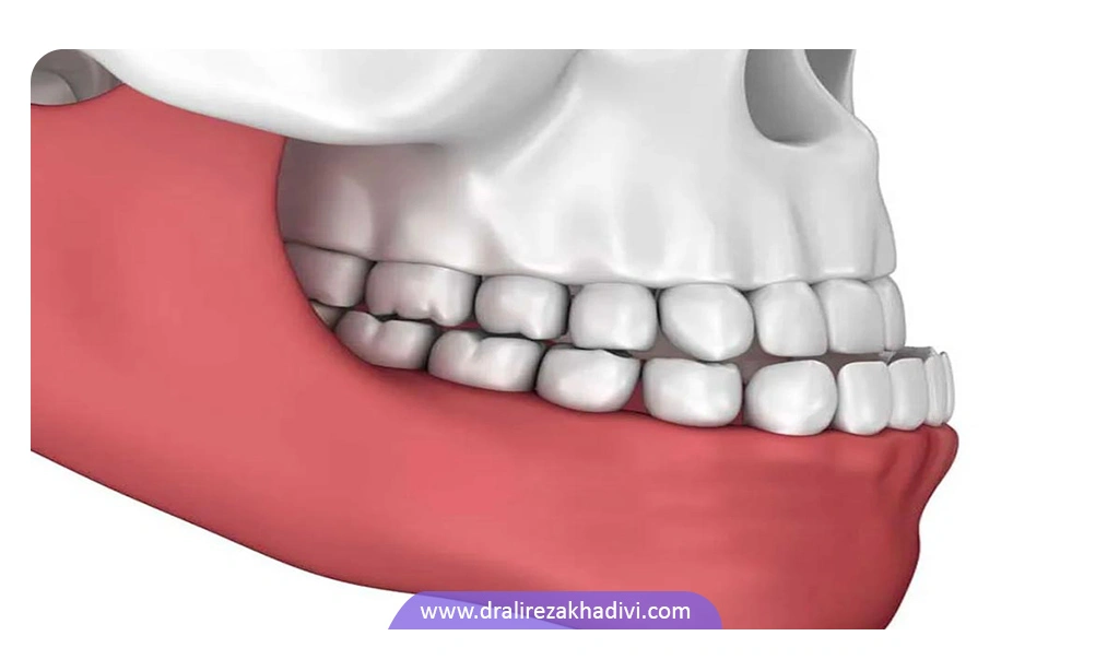 آندربایت چیست