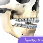 جراحی فک یا ارتودنسی