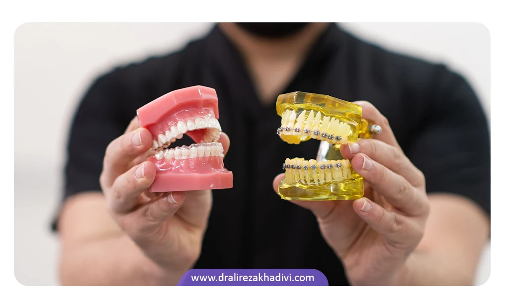 عکس انواع ارتودنسی ثابت و متحرک با الاینر شفاف